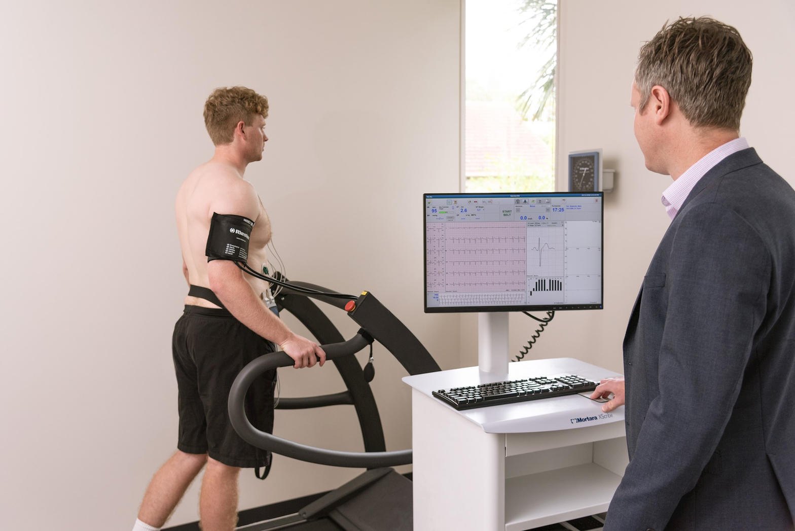 Patient walking on a medical treadmill during a supervised exercise stress test with ECG monitoring